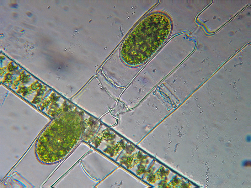 Coniugazione di Spirogyra
